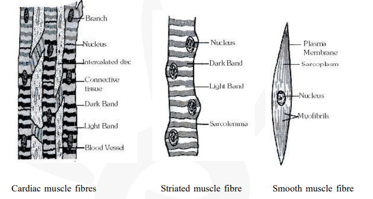 Diagramatically show the difference